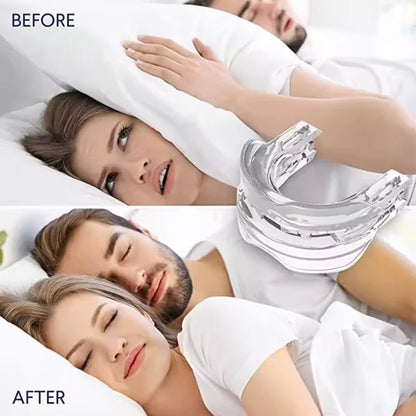 GoodSleep™  Solución efectiva contra los ronquidos